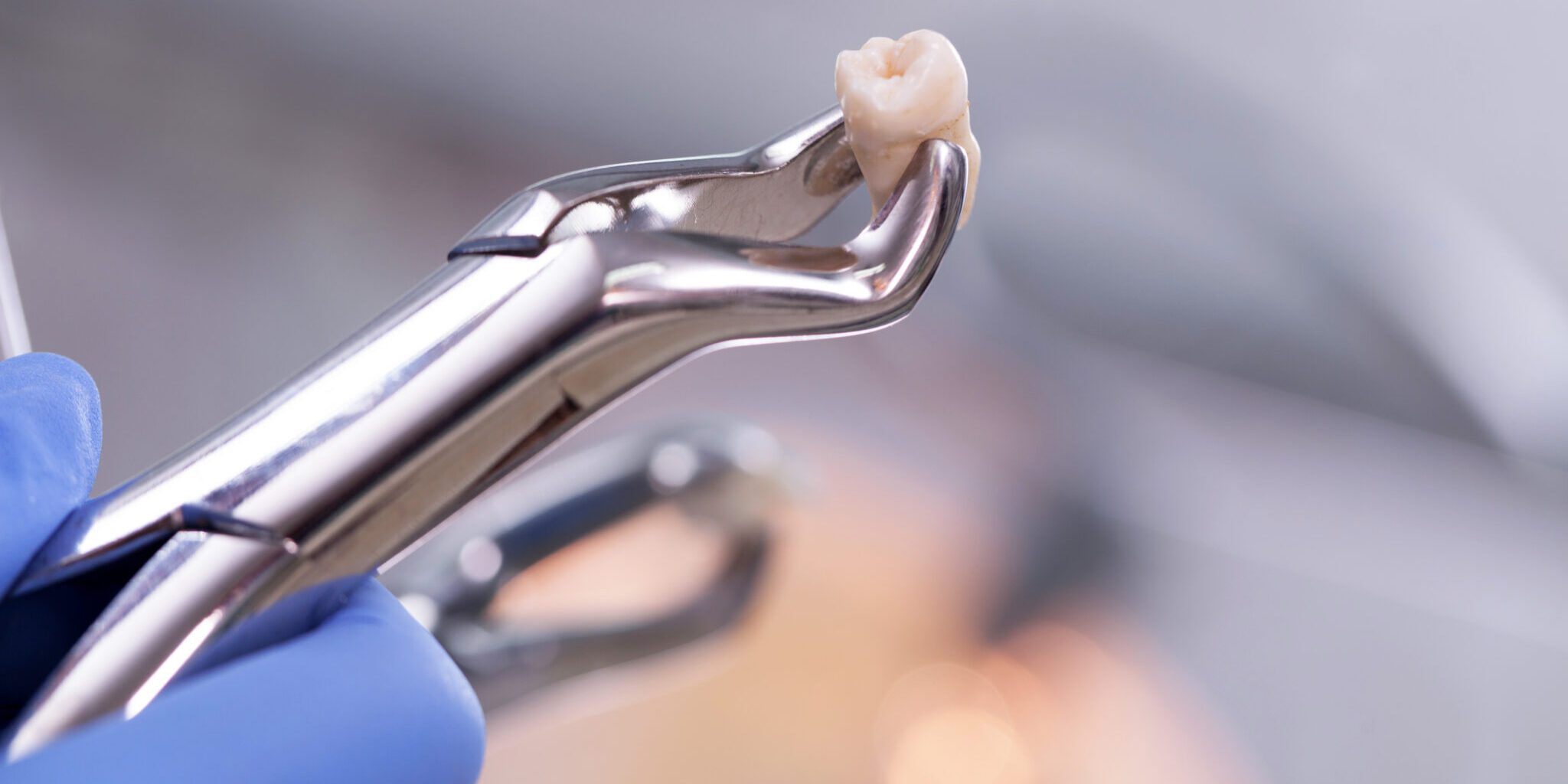 When is it best to preserve or extract a tooth?
